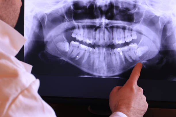 Best Emergency Denture Repair in Wheat Ridge, CO